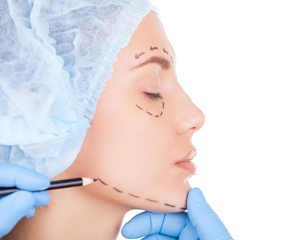 Facelift Surgery in Ludhiana