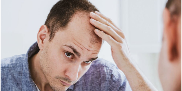 Hair Loss - Causes & Treatment Options