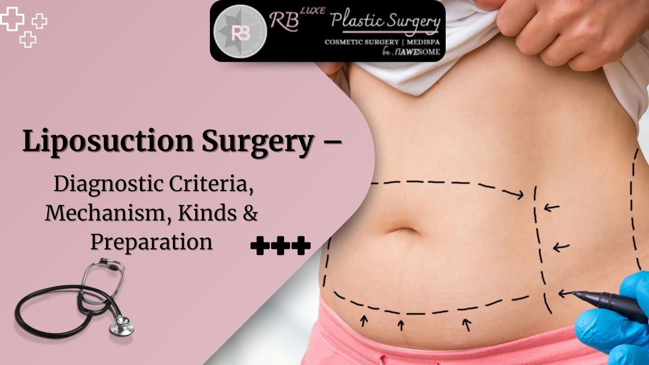 Liposuction Surgery - Diagnostic Criteria, Mechanism, Kinds & Preparation