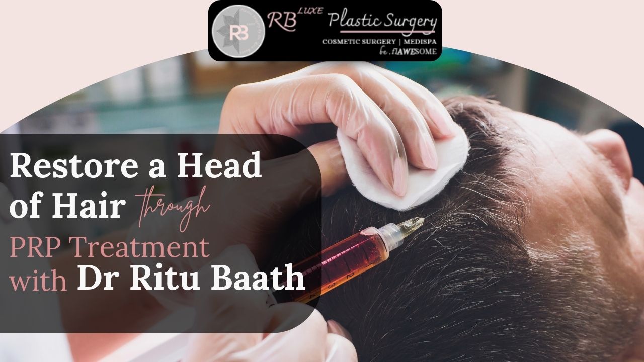 Restore a Head of Hair through PRP Treatment with Dr Ritu Baath